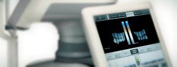 lipiview machine